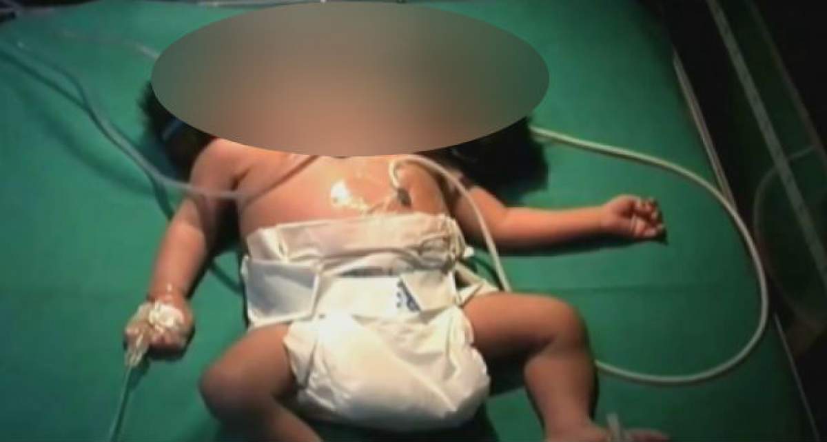 VIDEO ŞOCANT Medicii au încremenit când au văzut ce a născut această femeie: "E un monstru"