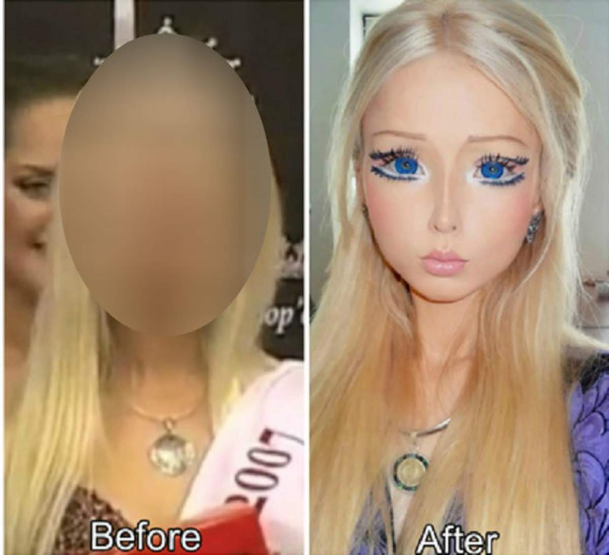 Poza asta te va şoca! Uite cum arăta femeia Barbie înainte să-şi facă intervenţiile chirurgicale!