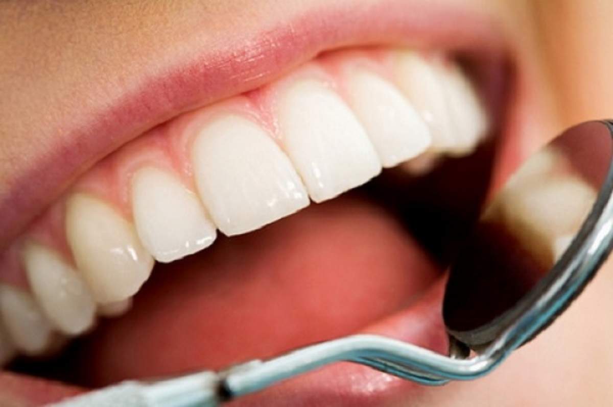 Vrei să ai dinţi albi, dar nu ai bani pentru un tratament la stomatolog? Uite cele mai eficiente metode pe care le poţi încerca acasă!