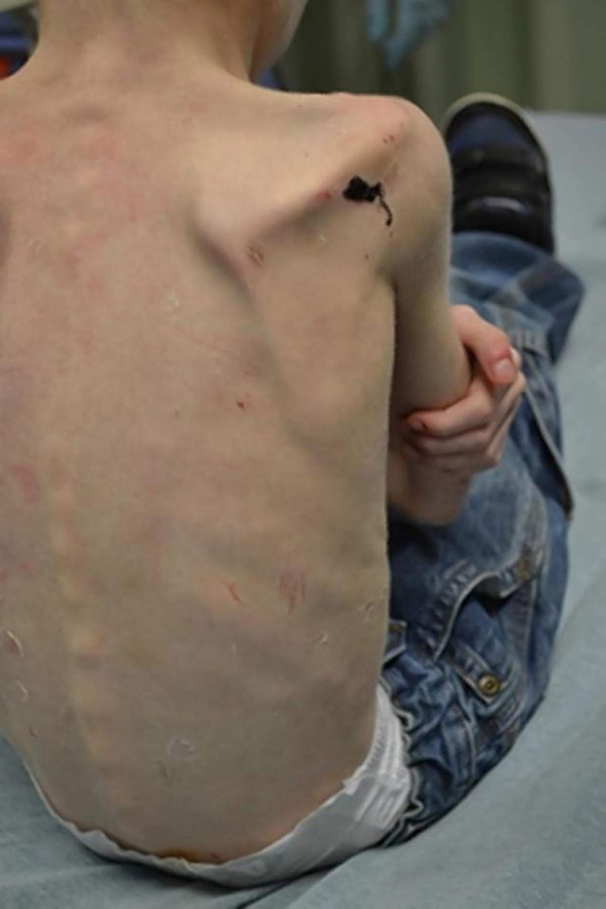 A fost ţinut încuiat în dulap timp de 2 ani! Cum arată copilul de 5 ani care a fost torturat de proprii părinţi