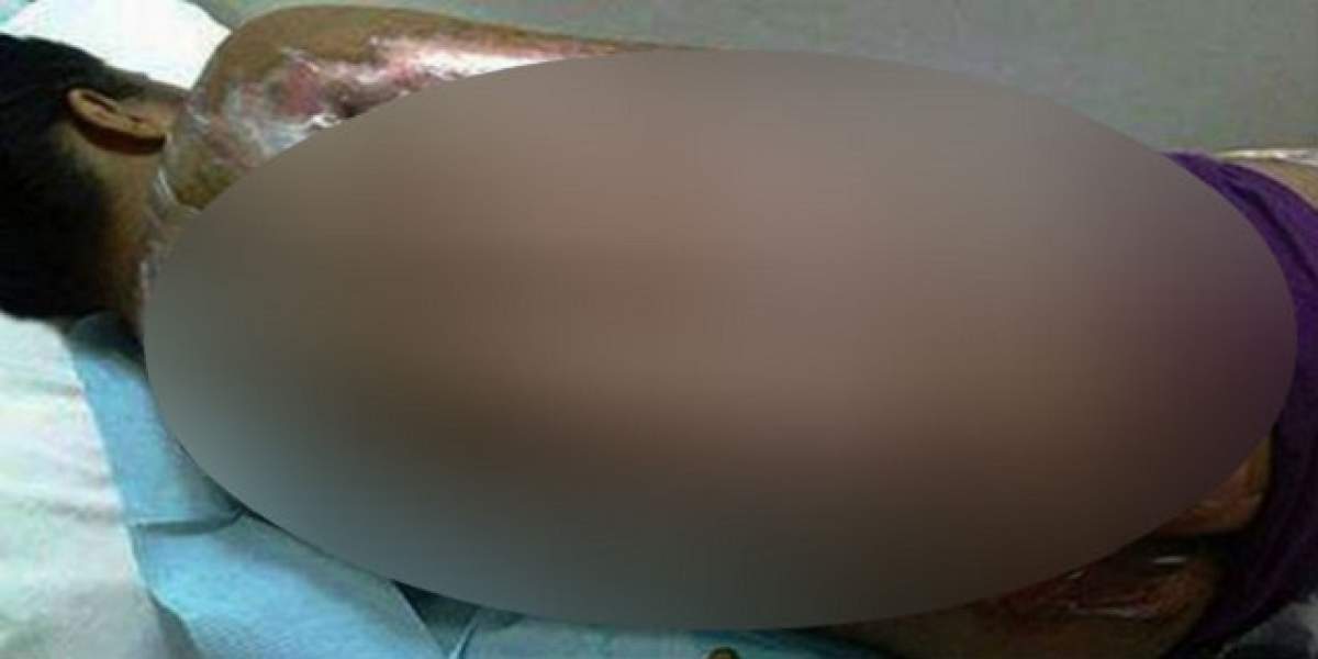 A ajuns la spital cu arsuri grave! Mama şefului s-a răzbunat pe ea dintr-un motiv INCREDIBIL