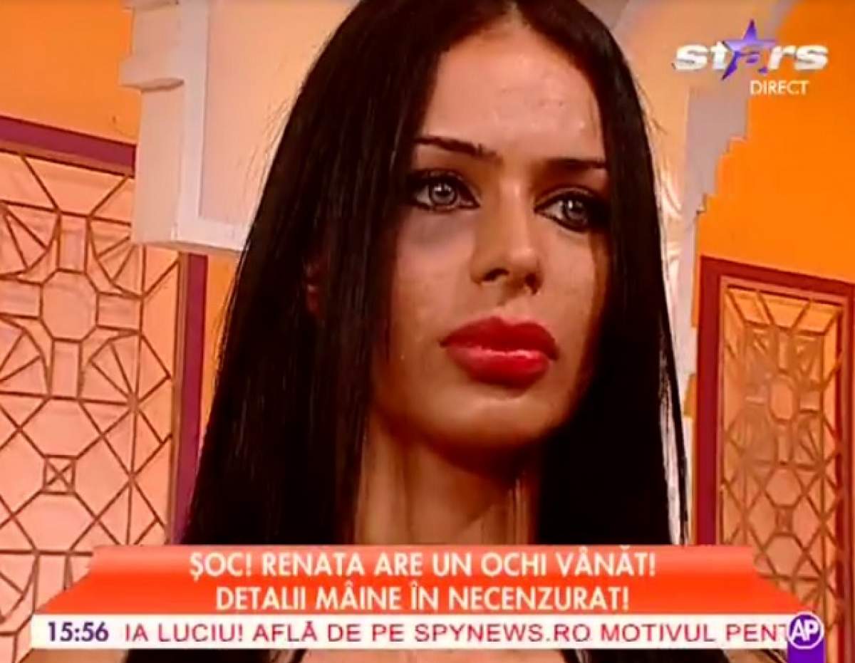 ŞOC! Renata a ieşit cu un ochi vânăt din relaţia cu Leo de la Strehaia! O fi bătut-o "prinţul ţiganilor"?