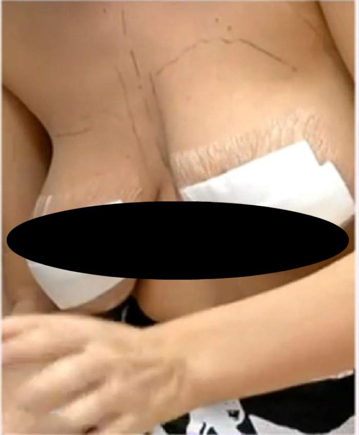 VIDEO Încă o vedetă o ia pe urmele Oanei Zăvoranu! Uite ce silicoane-şi pune şi cum arată sânii ei acum!