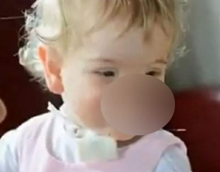 VIDEO S-a născut fără nas, dar zâmbeşte neîncetat! Cum arată fetiţa care a emoţionat milioane de oameni