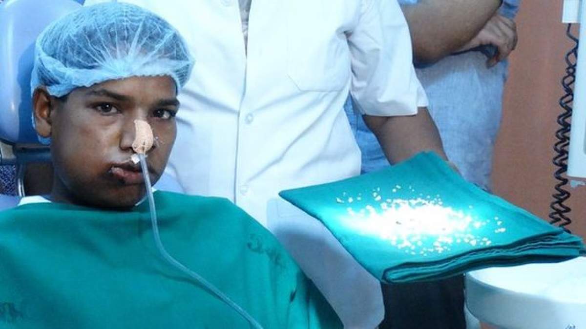 VIDEO INCREDIBIL! Stomatologii au scos 232 de dinţi din gura unui băiat