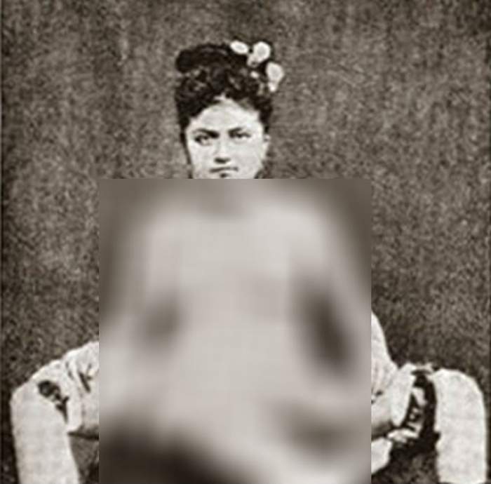 FOTO +18 Prostituata cu trei picioare a făcut furori la vremea ei! Bărbaţii care au fost cu ea susţin că i-a lăsat fără suflare! Uite cum arăta malformaţia