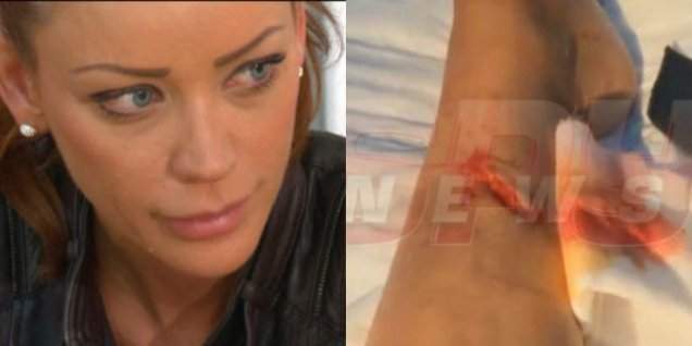 Bianca Drăguşanu A RECUNOSCUT! Motivul din cauza căruia s-a accidentat la picior este halucinant