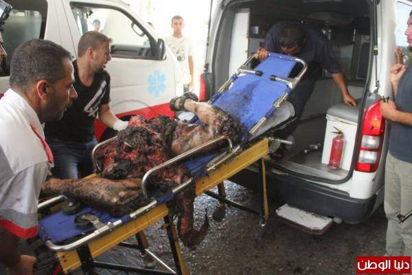 IMAGINI ŞOCANTE! Oameni decapitaţi şi copii ucişi de bombe!