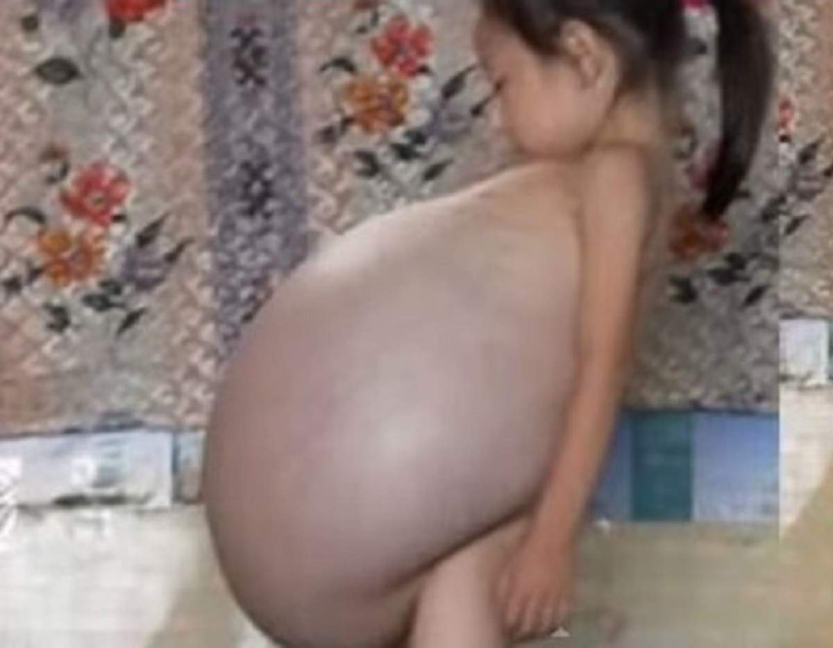 18+ Medicii au rămas şocaţi! Ea este fetiţa care are 4 ani, dar care arată ca o gravidă în 9 luni
