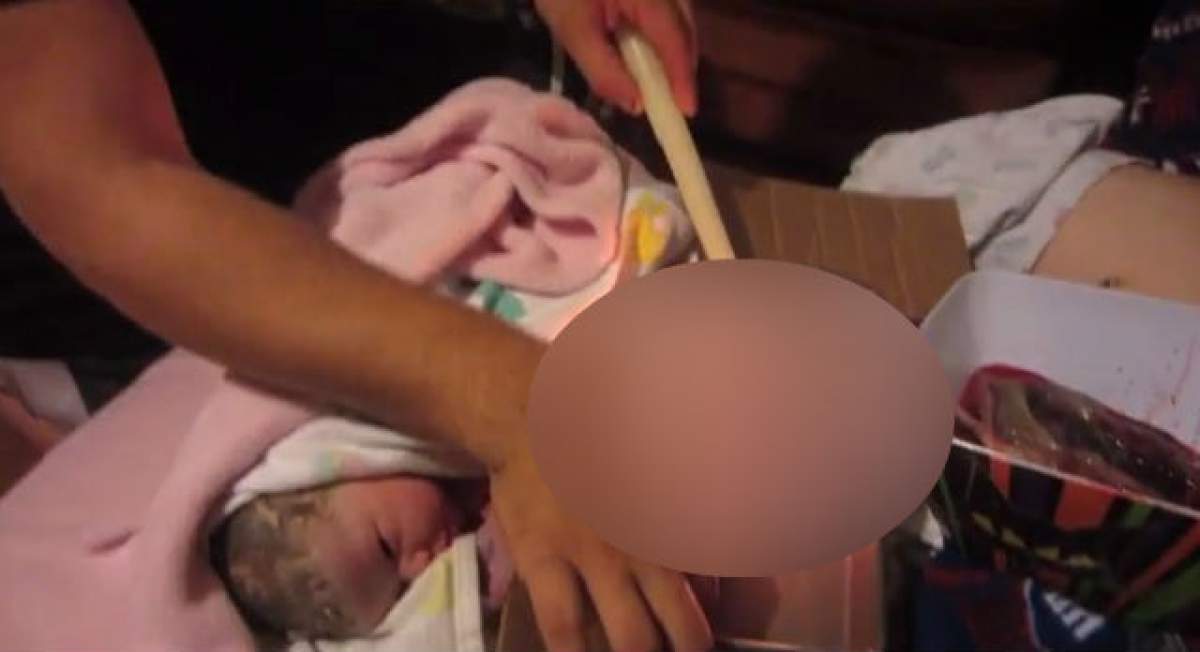 VIDEO ŞOCANT /  Noua tehnică de îndepărtare a cordonului ombilical al bebeluşului! Tu ai putea suporta aşa ceva?