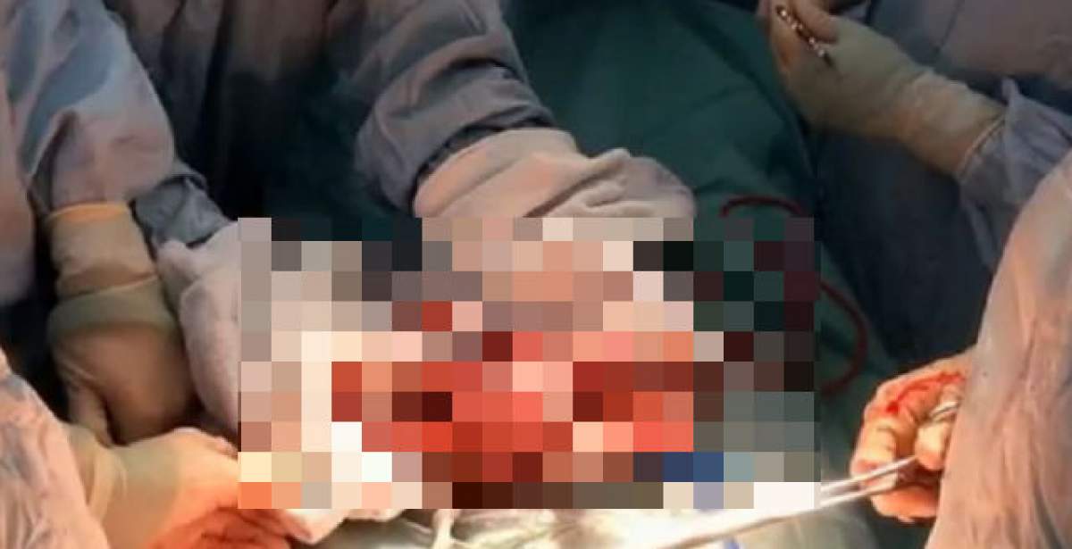 VIDEO/  Incredibil! Cum arată un avorton la 24 de săptămâni: "E o fiinţă umană, nu un fetus"