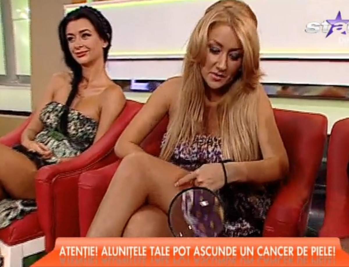 VIDEO / Fetele de la Bambi, consultate în direct! Alunițele pot ascunde cancer de piele