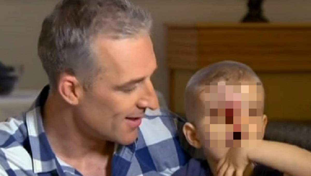VIDEO/ Băiatul născut fără faţă, salvat după ce povestea lui a apărut pe Facebook! Cum arată micuţul
