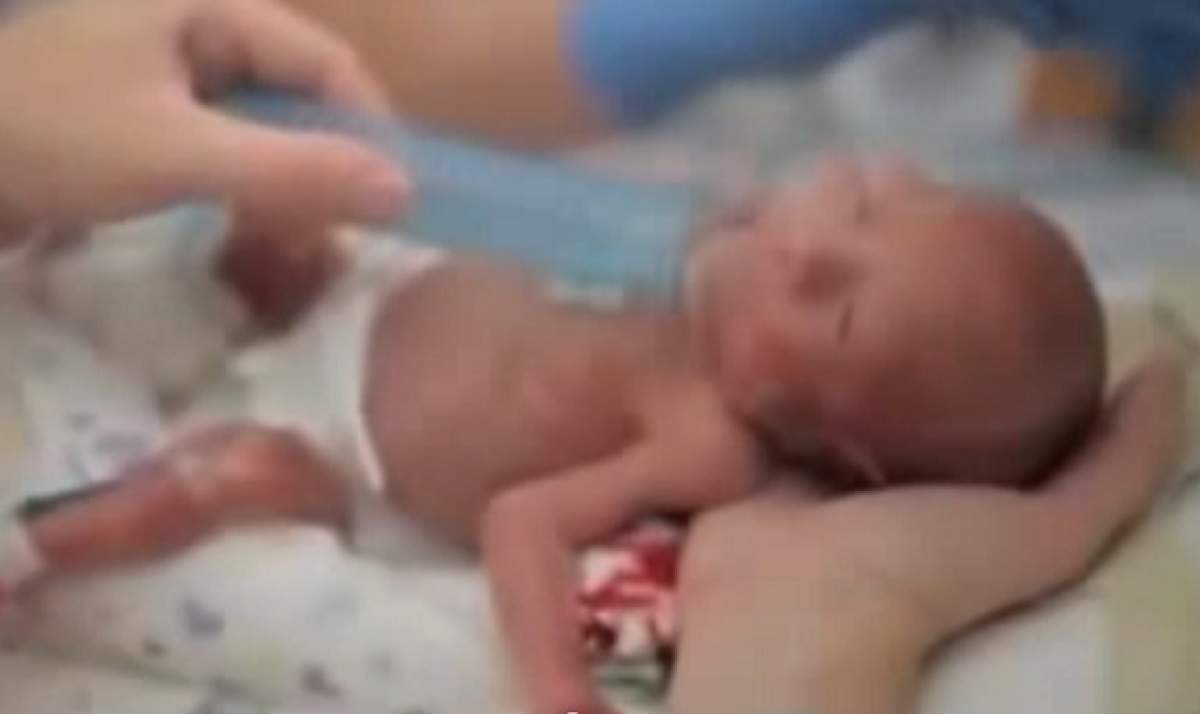 VIDEO / Te lasă fără cuvinte! Cum arată primul an din viaţa unui bebeluş născut după doar 5 luni de sarcină