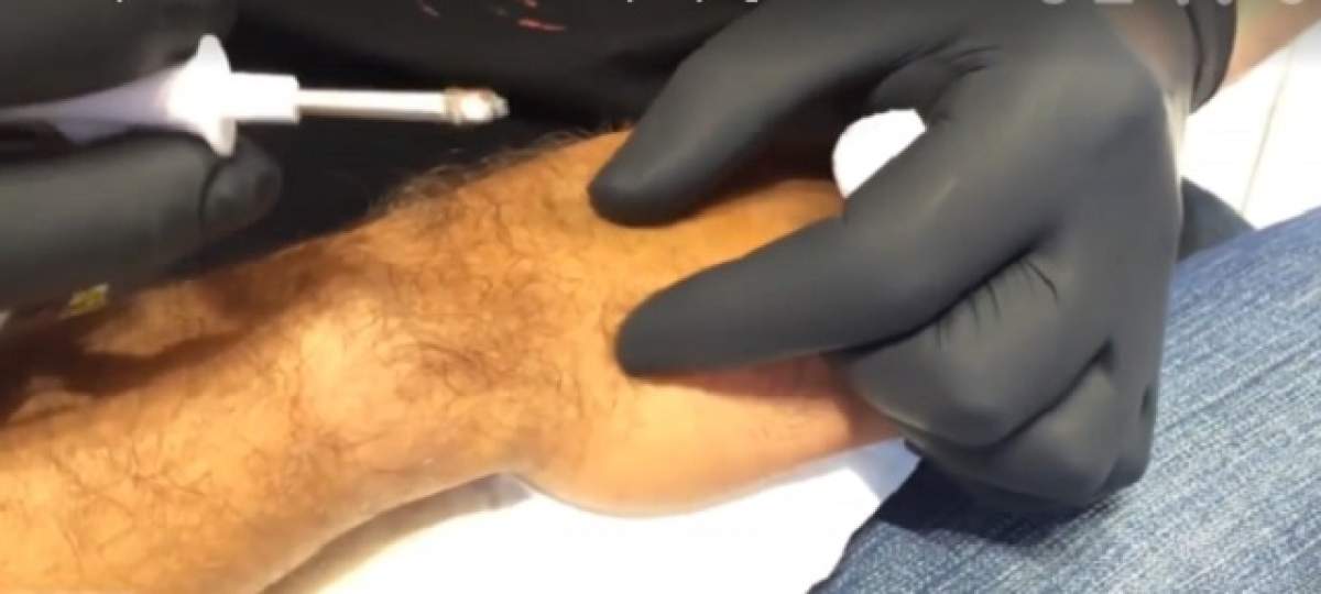 VIDEO / INCREDIBIL! Motivul pentru care un bărbat şi-a inserat un microcip în mână!