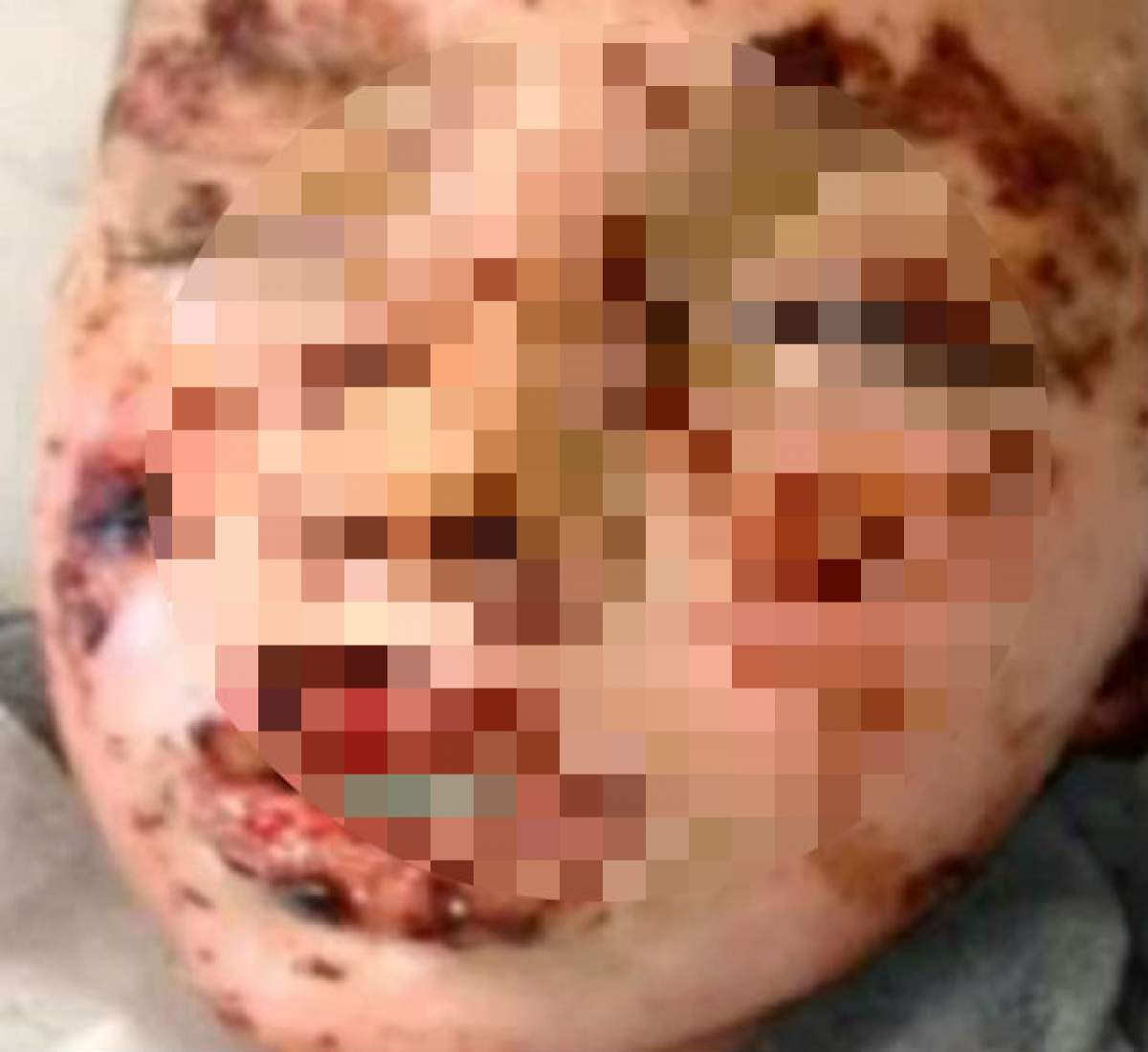 Atenţie, imagini şocante! Ce a păţit un băiat de 13 ani după ce a luat o pastilă pentru răceală şi gripă