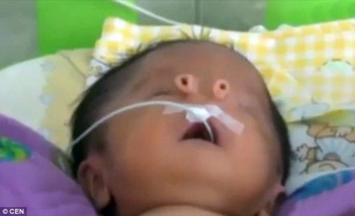 VIDEO / Se numeşte "Înger", dar arată înfiorător! Un bebeluş s-a născut cu două tuburi în loc de nări