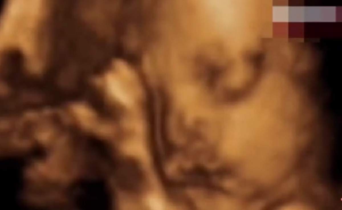 VIDEO / Minune! Imaginea bunicului a apărut în ecografia nepotului nenăscut