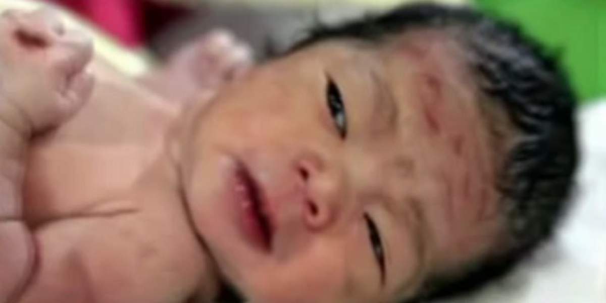 VIDEO / Bebeluşul născut cu "rănile lui Hristos". Ce se ascunde în spatele IMAGINILOR care au ŞOCAT LUMEA