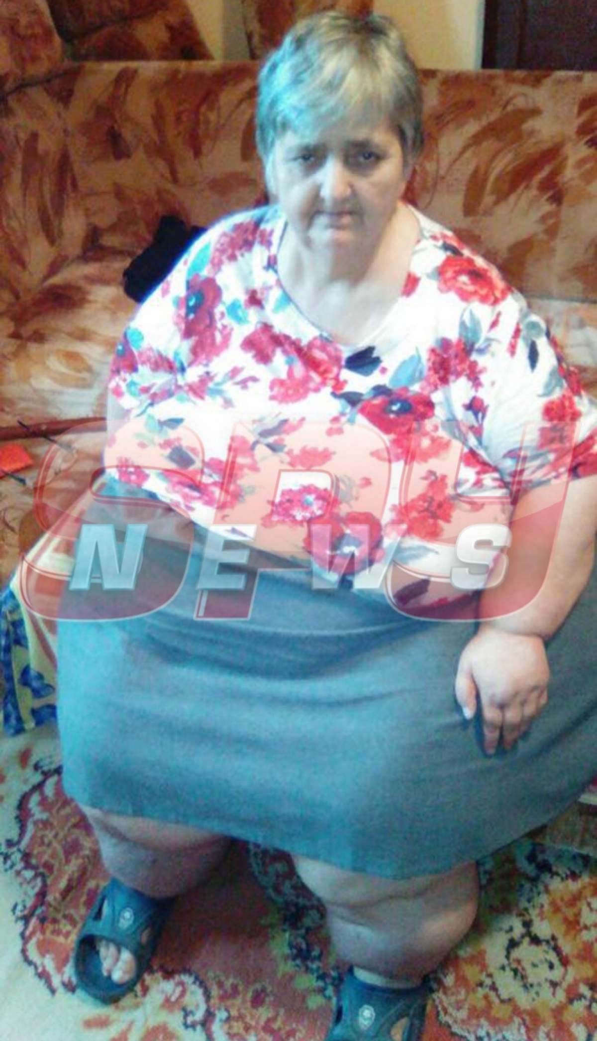 SCANDALOS / Cum a fost umilită în spital femeia care cântăreşte 200 de kilograme!