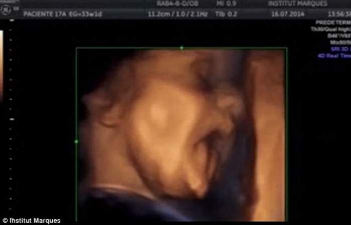 VIDEO / A auzit muzică şi a reacţionat! Un fetus i-a lăsat mască pe oamenii de ştiinţă! Uite ce a făcut