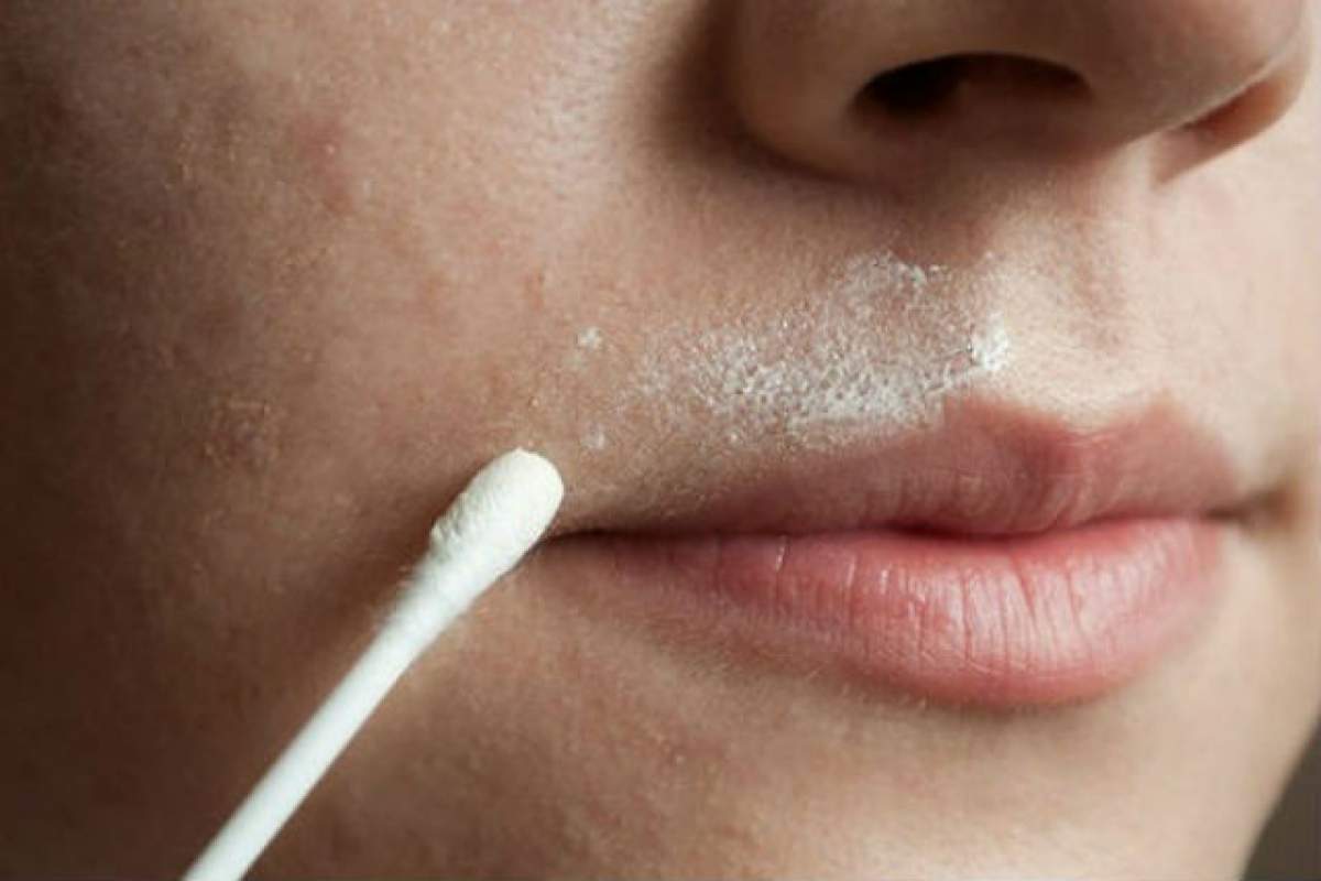 Soluţia FABULOASĂ la care nu te-ai fi gândit până acum! Scapă de părul FACIAL pe cale NATURALĂ, pentru totdeauna, cu o reţetă REVOLUŢIONARĂ!