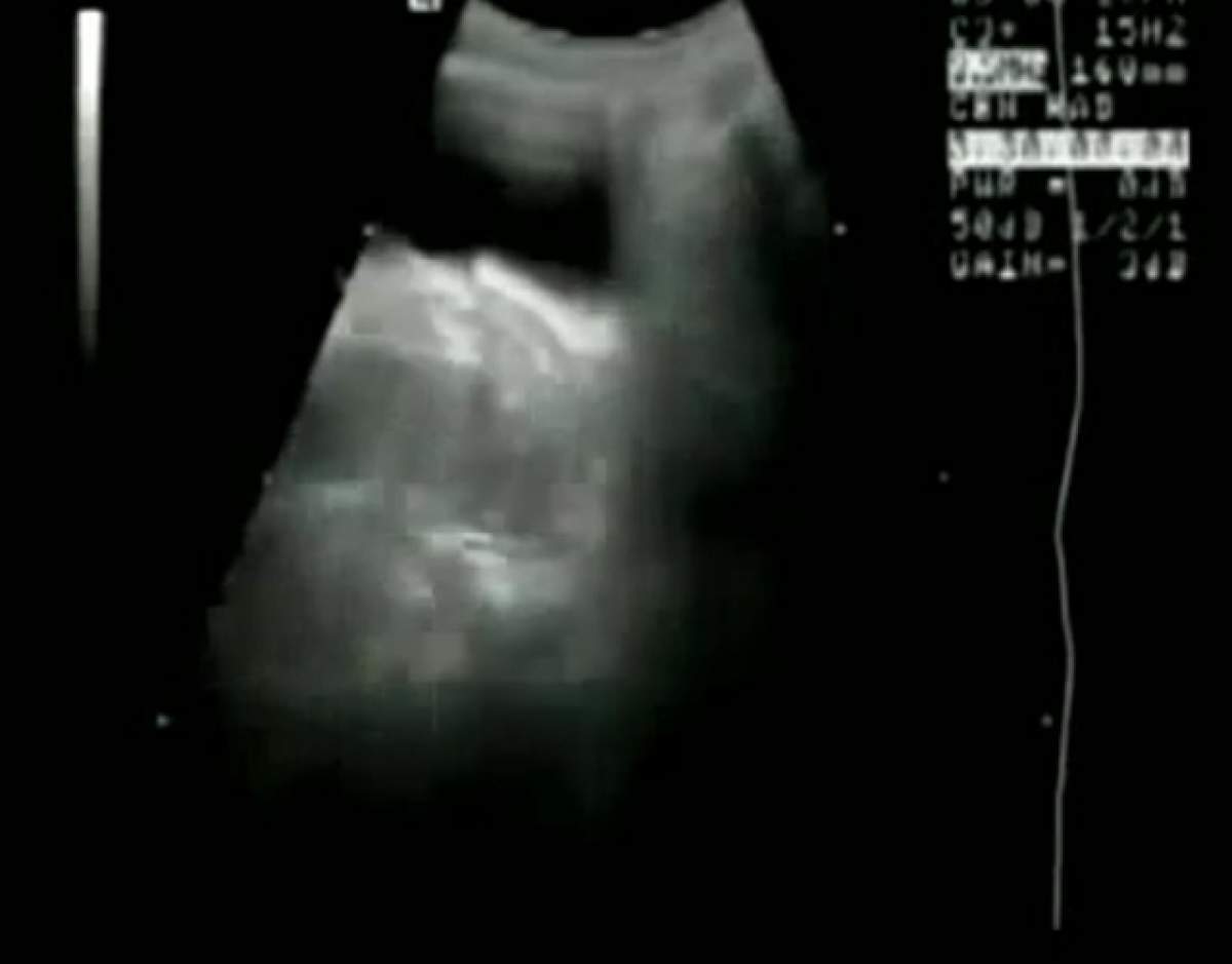 VIDEO / Au filmat cuplurile făcând sex în spatele unui scanner! Imagini quatrodimensionale din timpul unei tomografii