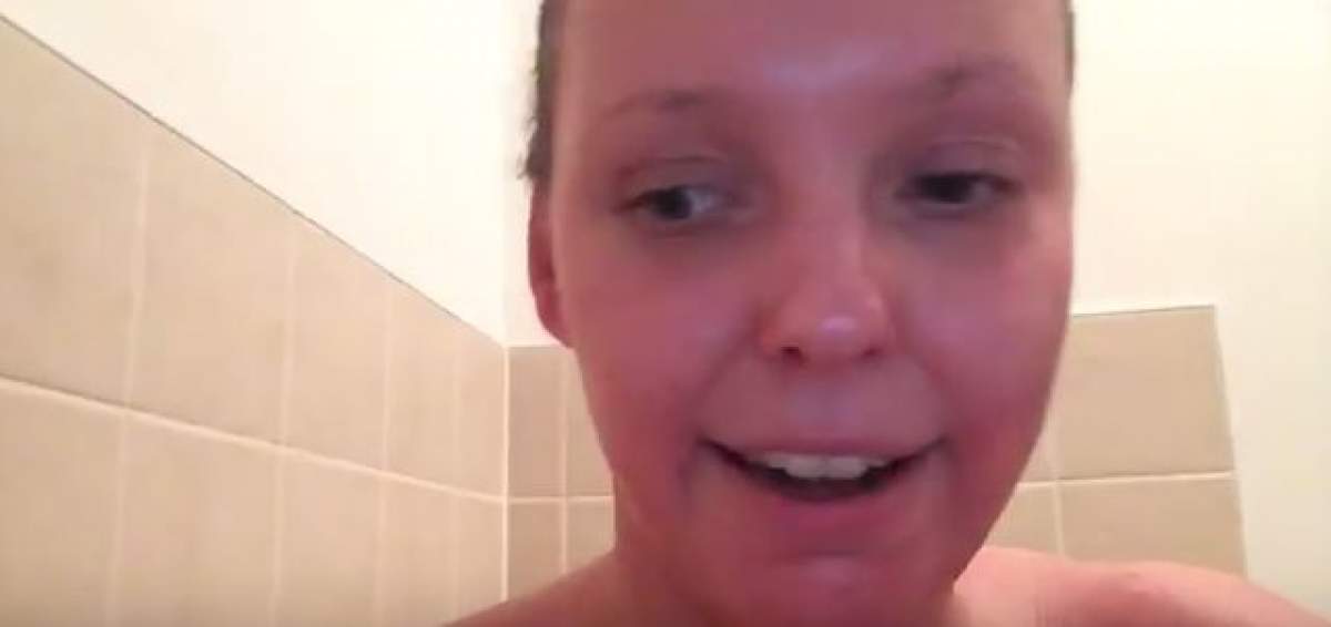 VIDEO / Poveste şocantă a unei tinere din Marea Britanie! S-a trezit într-o dimineaţă şi a văzut cum îi cădea pielea de pe ea!