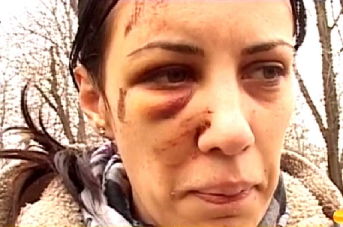 VIDEO / Dezvăluiri din IAD! Alexandra Gavrilă, tânăra bătută de fostul iubit: "Mi-a zis că toarnă benzină pe mine şi îmi dă foc"