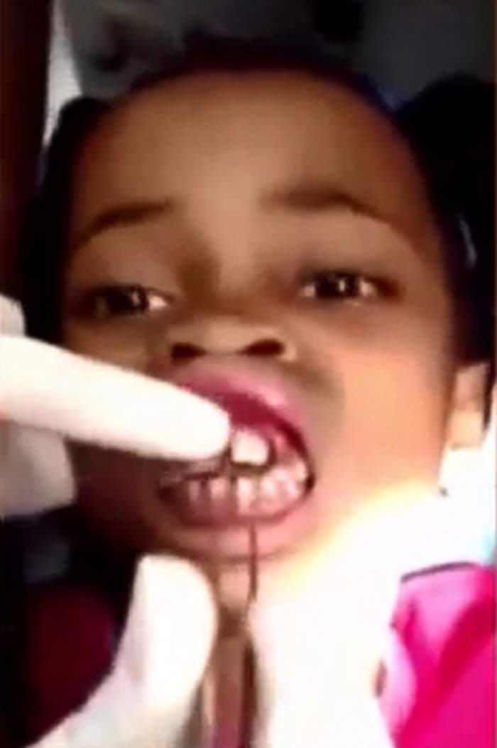 VIDEO / Ţi se întoarce stomacul pe dos! Ce a găsit un dentist în gura unei fete: "Ceva se mişcă!"