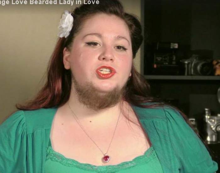 VIDEO / A fost diagnosticată cu o afecţiune comună şi a ajuns să arate aşa! Povestea şocantă a femeii cu barbă
