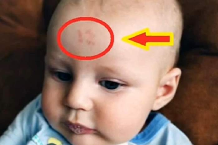 VIDEO / Un bebeluş s-a născut cu cifra magică 12 în frunte! Ce semnifică asta