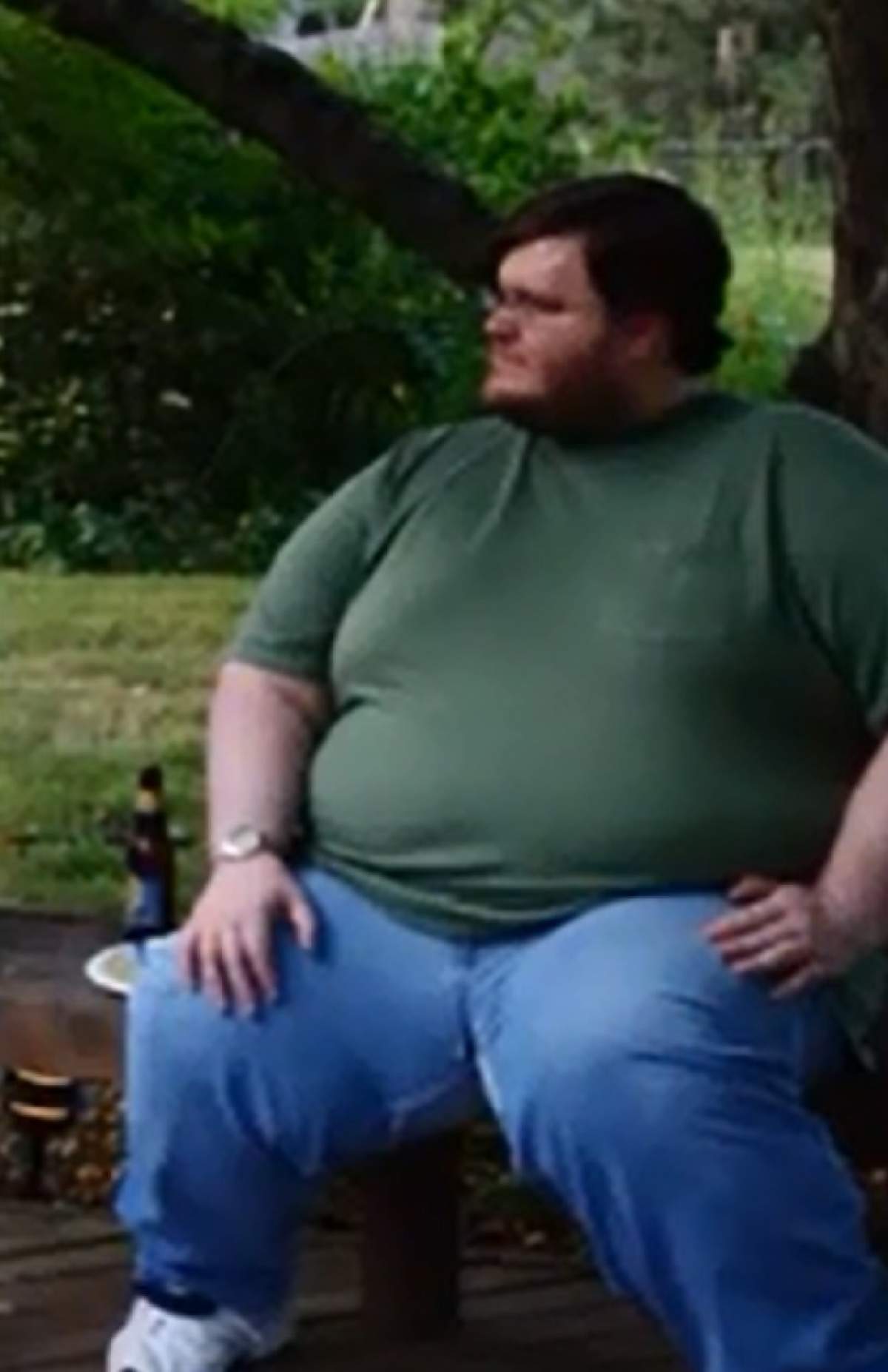 VIDEO / Un bărbat a slăbit 165 de kilograme, iar acum arată HIDOS! Uite cum îi atârnă pielea