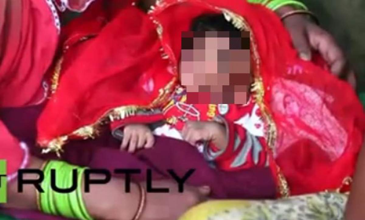 VIDEO / Medicii şi familia sunt în şoc! Cum arată copilul cu "trompă de elefant"