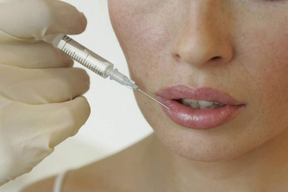 Cum să ai buzele voluptoase în mod natural, fără să apelezi la botox? Efectul e vizibil în doar 3 minute