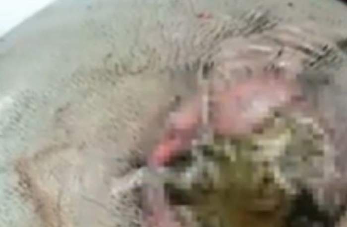 VIDEO /  Imagini cu puternic impact emoţional! Viermii i-au invadat capul! Medicii au fost îngroziţi când au văzut ce-i iese din scalp