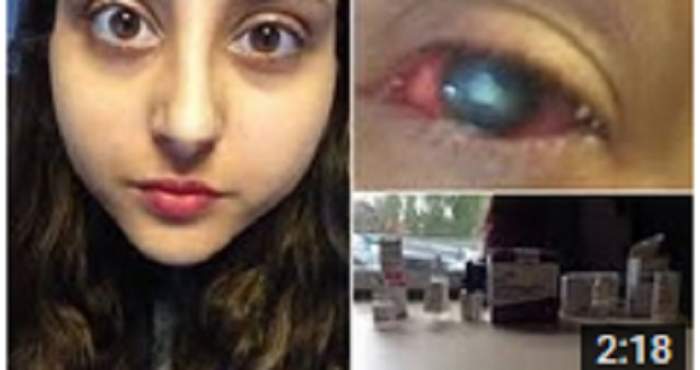 VIDEO / O studentă s-a trezit cu un vierme în ochi! Ce a păţit tânăra din cauza lentilelor de contact
