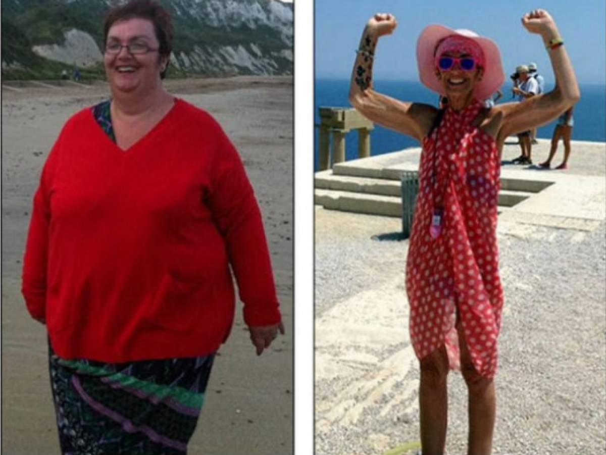 În doi ani de zile a trecut de la obezitate la anorexie. Povestea uluitoare a unei femei din Marea Britanie