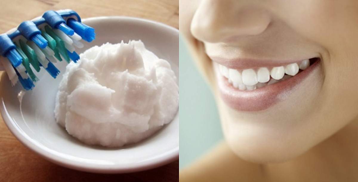 ÎNTREBAREA ZILEI: MARŢI - Cum să-ţi prepari acasă o pastă de dinţi naturală şi cu efect de albire?