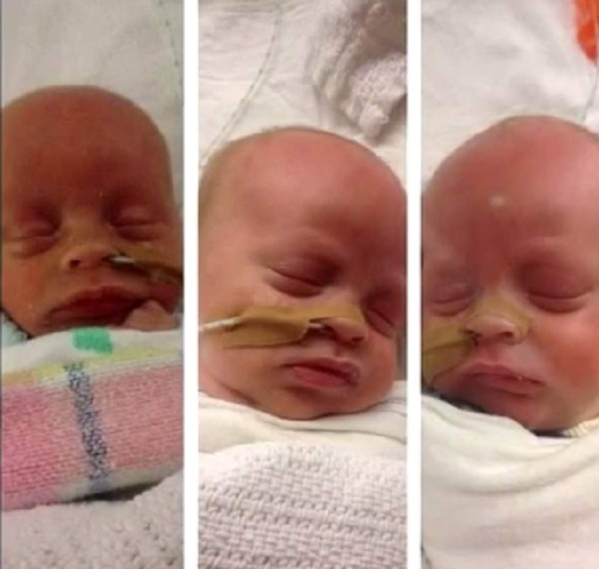VIDEO / Poveste adevărată! Un bebeluş a uimit medicii din întreaga lume! Ce au descoperit aceştia după ce au văzut placenta