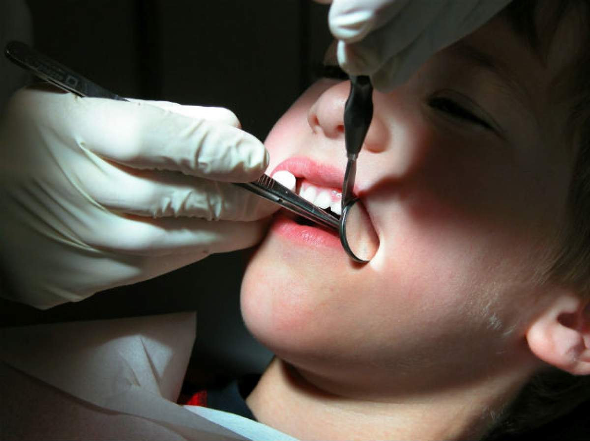 Cum este posibil să vindeci o carie fără să mergi la stomatolog