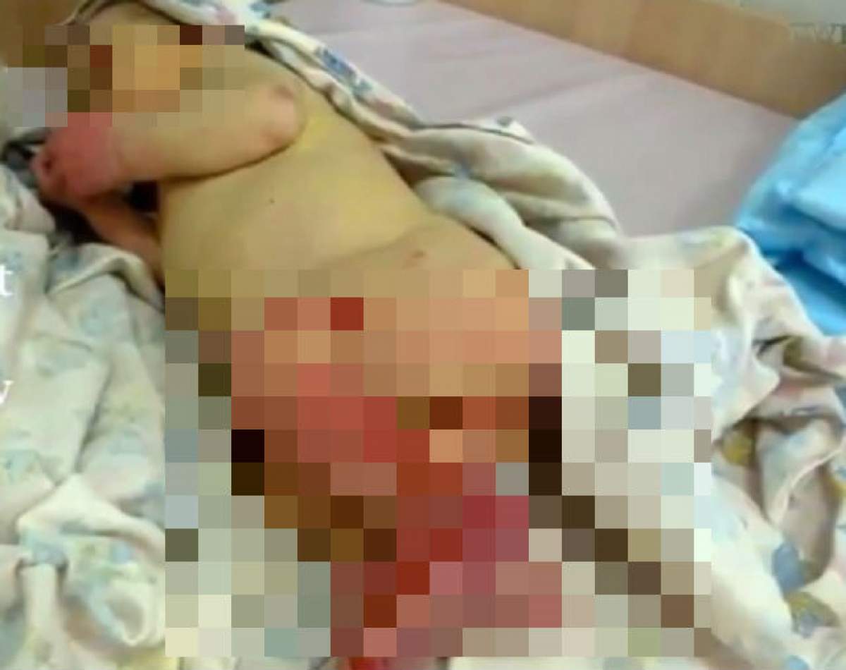 VIDEO / Imagini greu de privit! Un nou născut a fost abandonat şi lăsat să fie mâncat de furnici