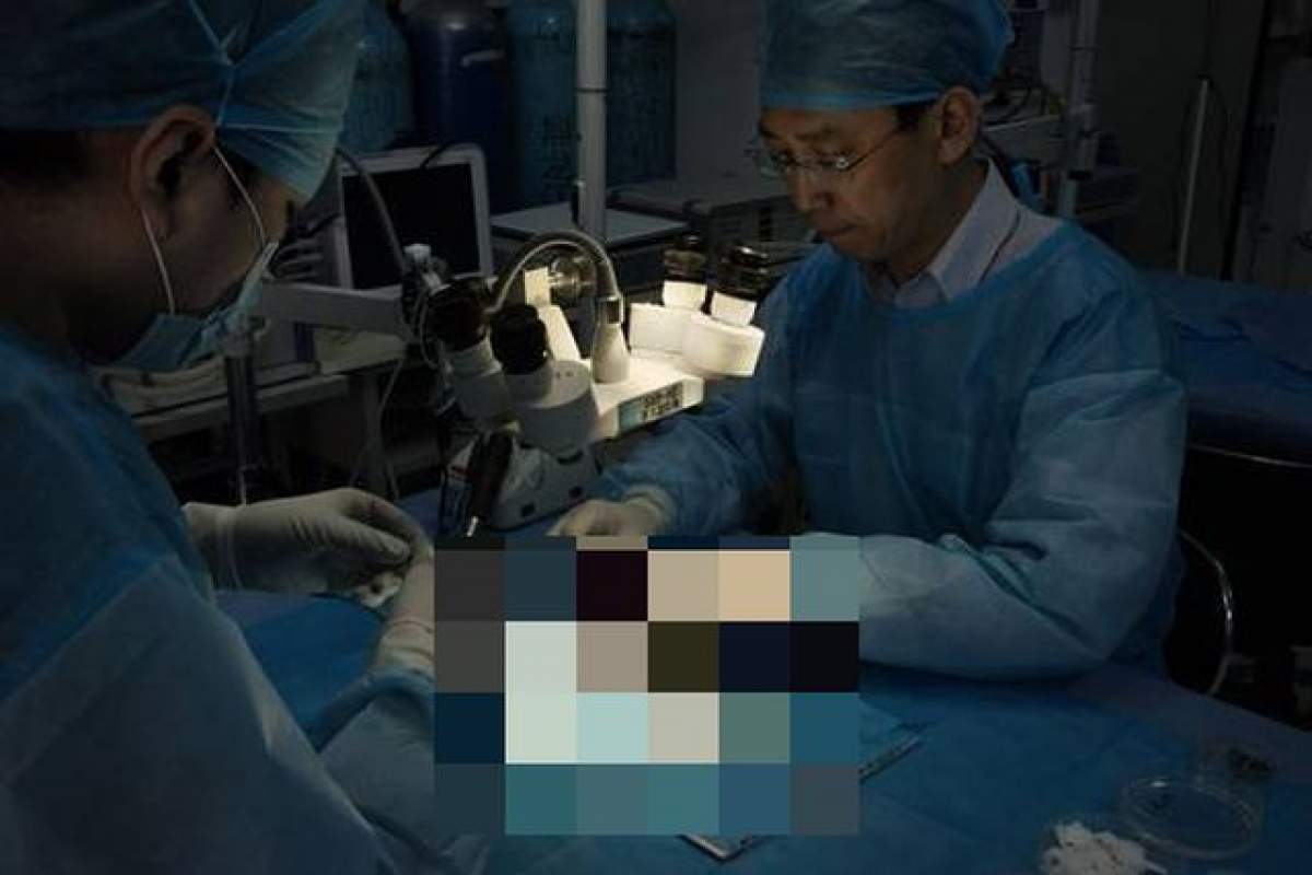 VIDEO / Bărbatul care a făcut peste 1.000 de transplanturi de cap