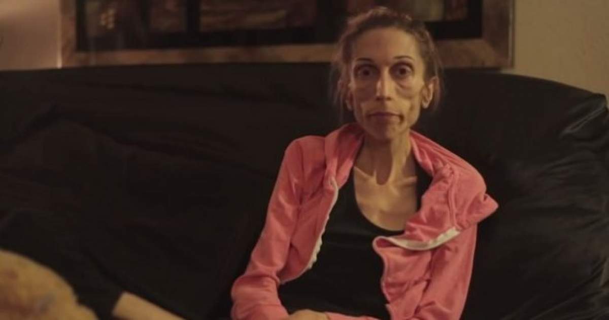 VIDEO / Drumul spre vindecare! Ce se întâmplă cu femeia care la 37 de ani cântăreşte 18 kilograme
