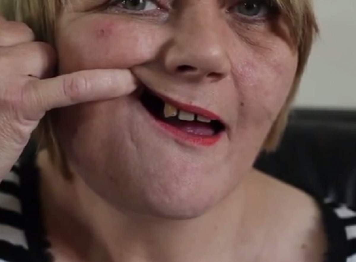 VIDEO / O femeie s-a dus să-şi facă histerectomie şi s-a trezit fără doi dinţi. Cum a fost posibil aşa ceva