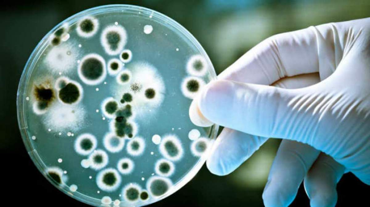 Cum afli dacă ai o suprainfecţie cu bacteria candida? Iată trei teste care îţi dau răspunsul