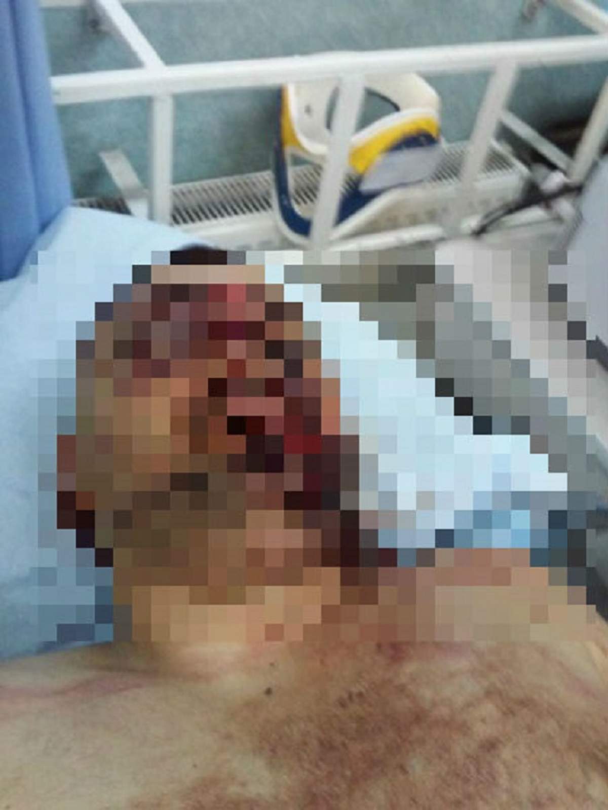 Bătăi cu săbii în faţa sediului IPJ Timiş! Un bărbat a ajuns la spital cu sabia înfiptă în cap! Imagini explicite terifiante