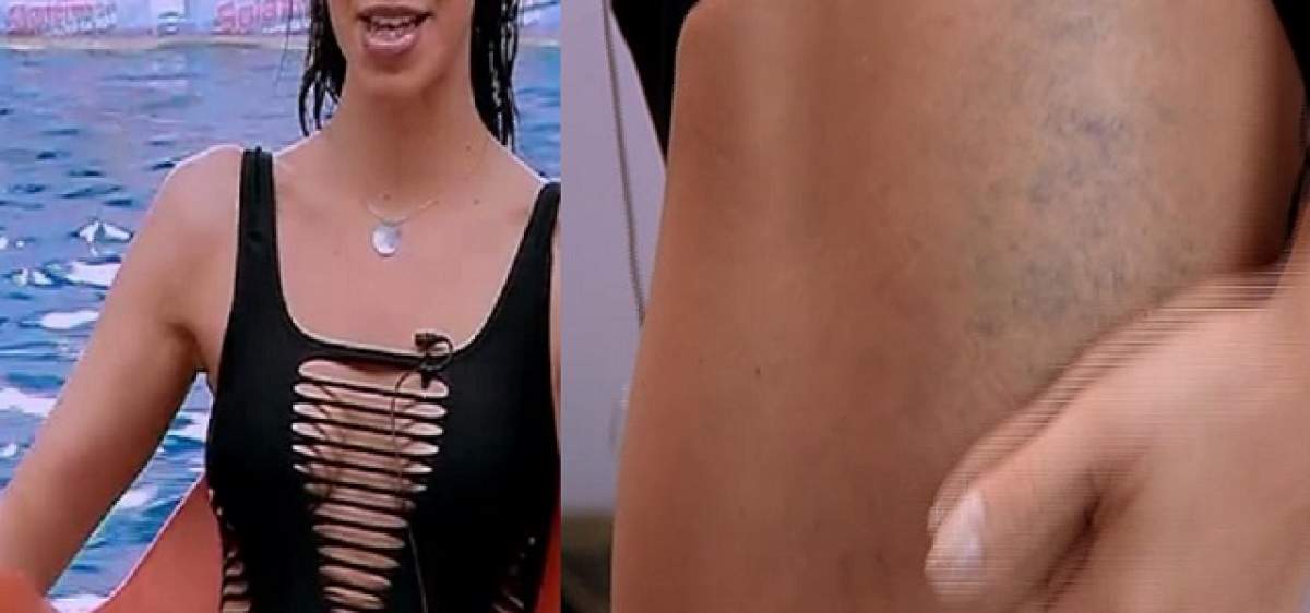 VIDEO / Divă, divă, dar vânătăile nu au ocolit-o! S-a învineţit toată, dar a făcut show la "Splash! Vedete la apă"