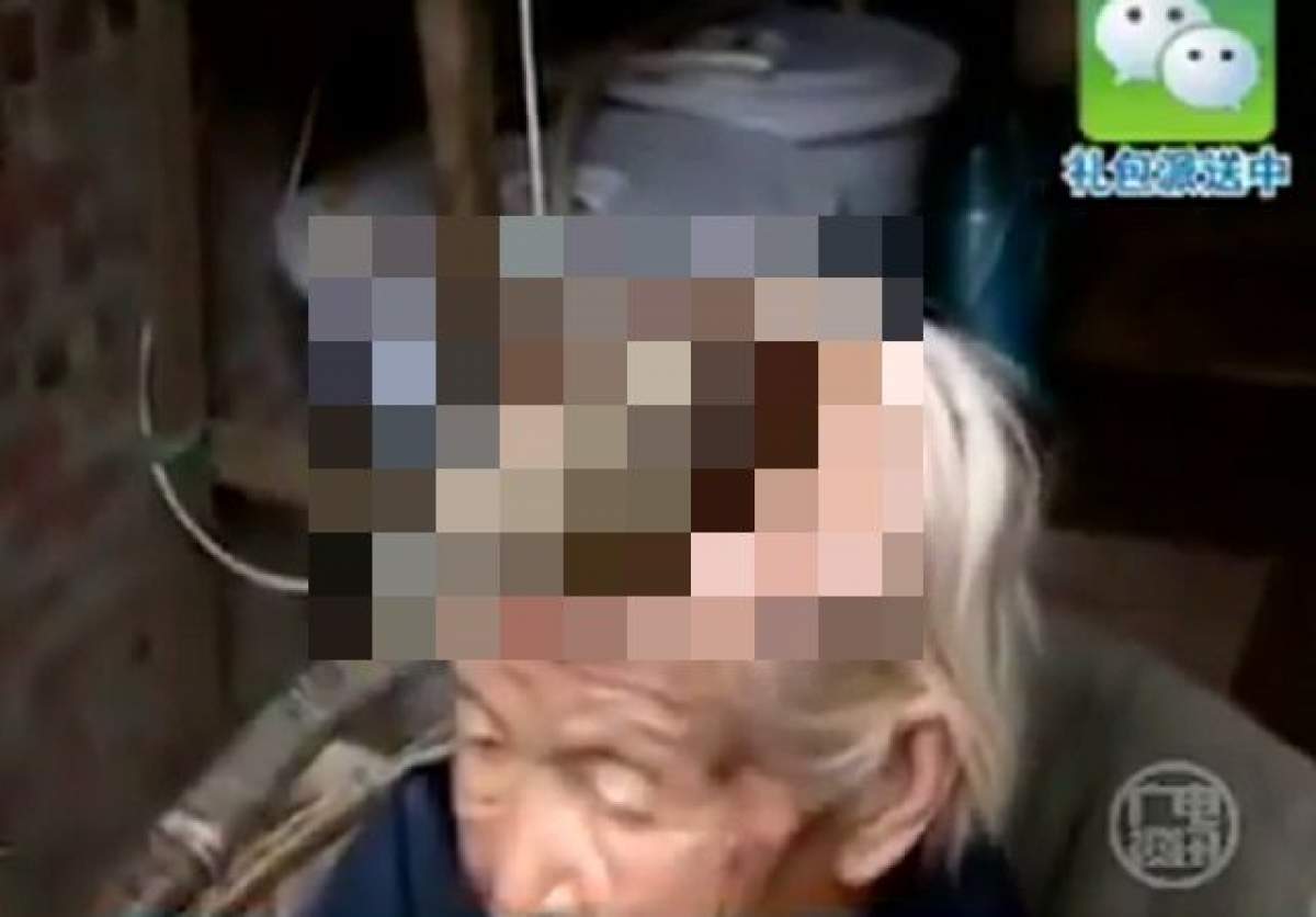 VIDEO / Terifiant! Unei femei de 87 de ani i-a crescut un corn imens în frunte