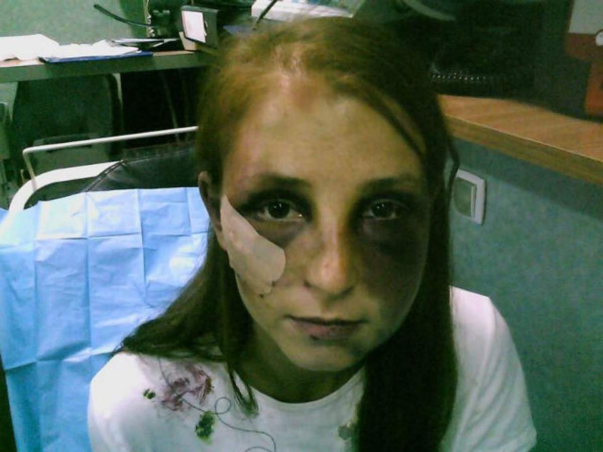 VIDEO / Caz şocant! A fost torturată de iubitul ei timp de 22 de ore: "Dădea în mine cu cureaua parcă bătea covorul"